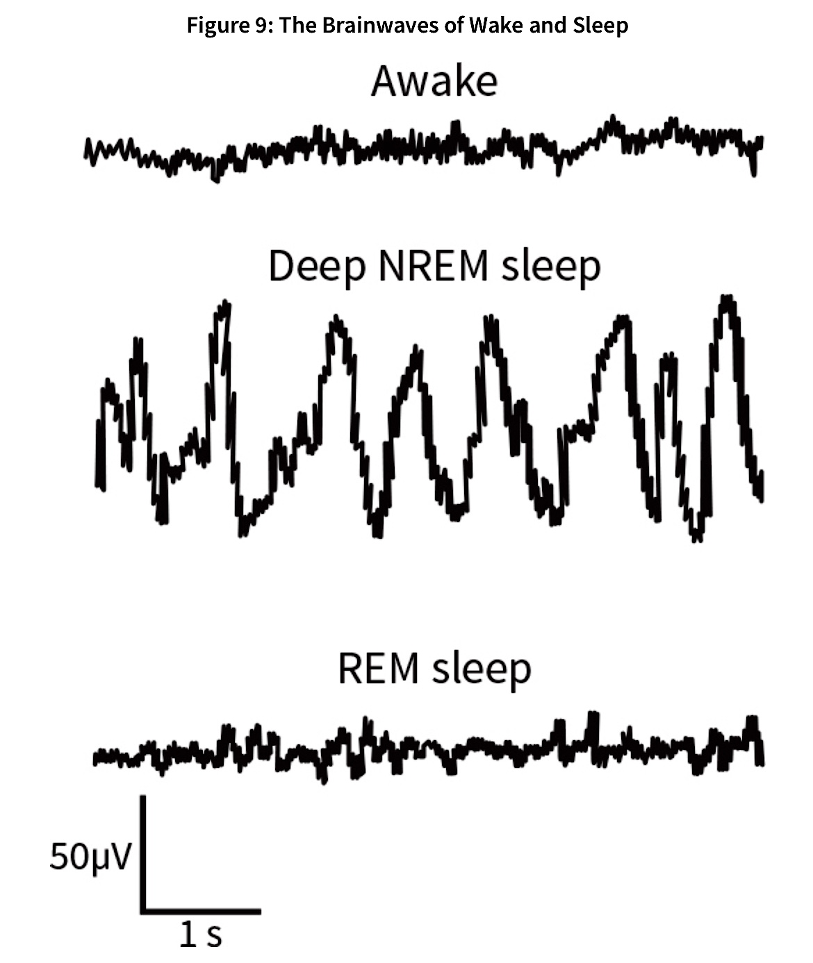 sleep-brainwaves